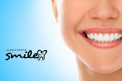 sonrisa de Estetica dental Barcelona